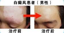 十年苦求医治路，停止于南通l00
